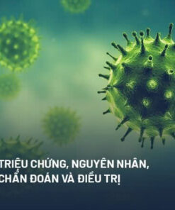Triệu chứng Cúm A và cách phòng ngừa