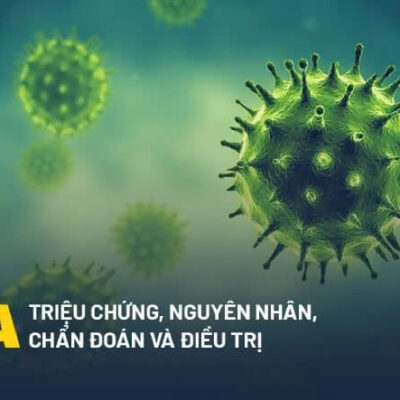 Triệu chứng Cúm A và cách phòng ngừa